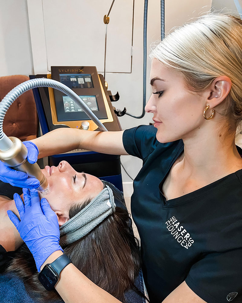 candidate-for-rf-microneedling-estero-fl