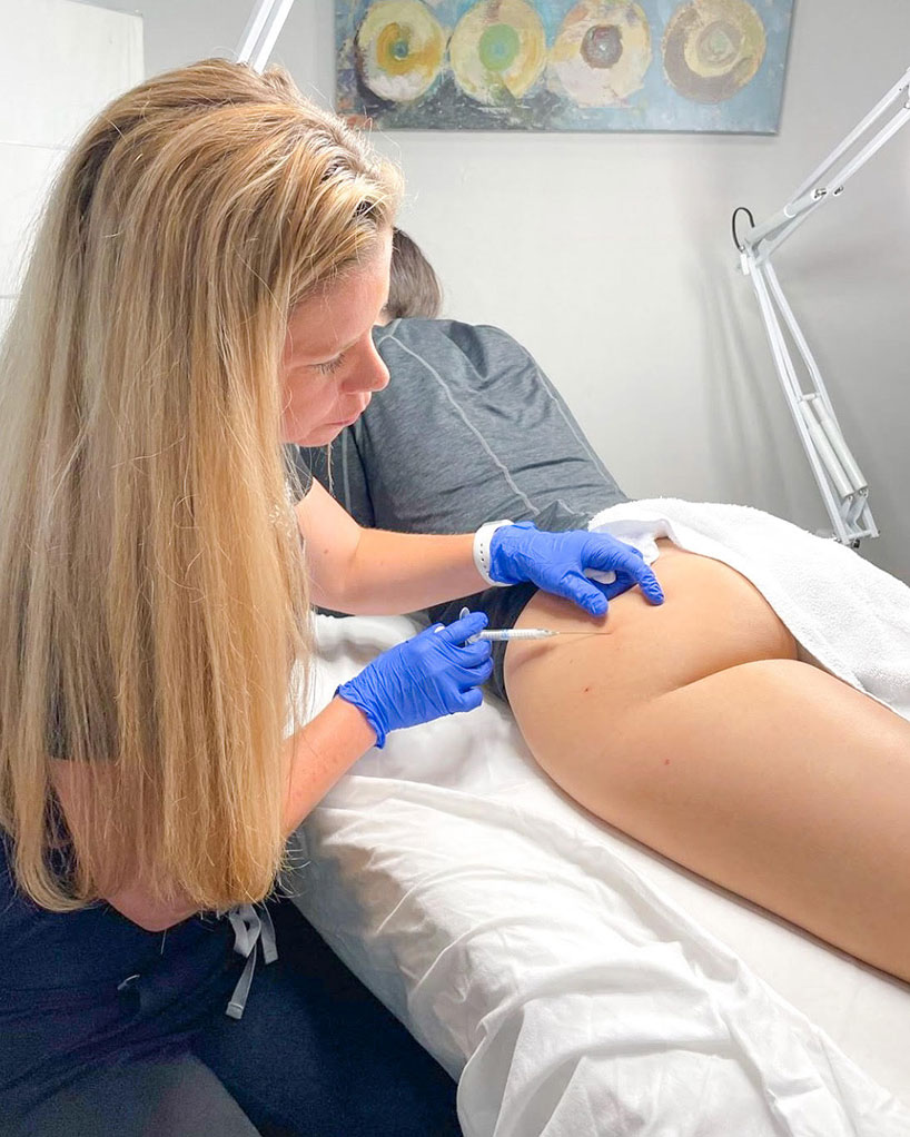 filler-for-butt-laser-lounge-estero