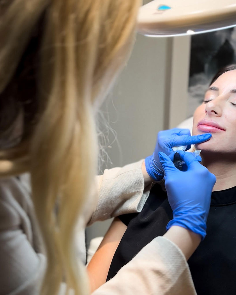 giving-chin-filler-laser-lounge-spa-estero