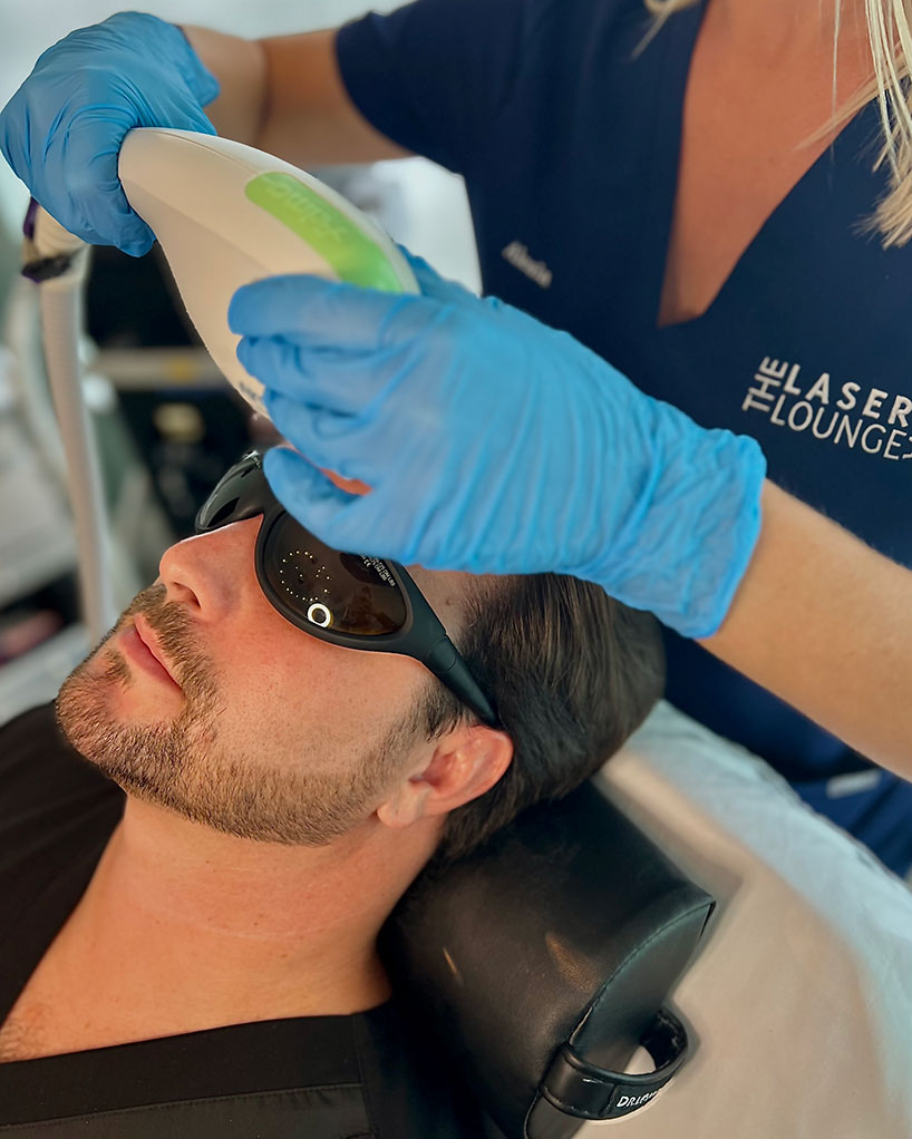 ipl-laser-lounge-estero