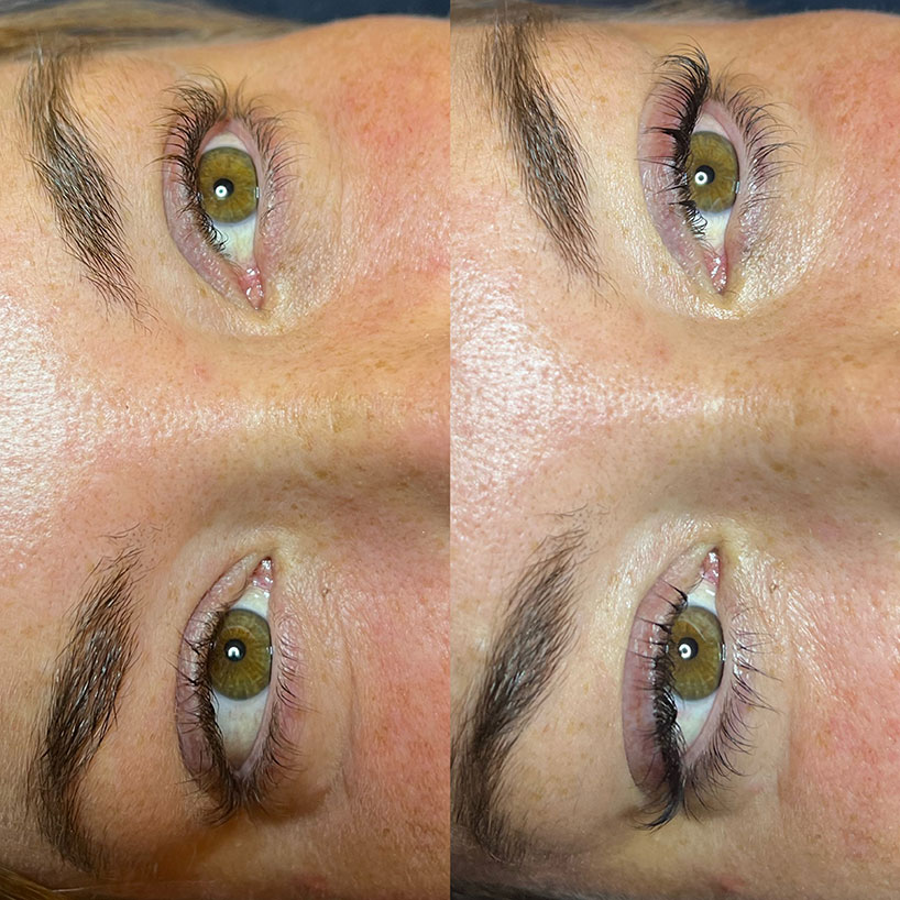 lash-lift-lash-tint-the-laser-lounge-spa-estero-1-before-and-after