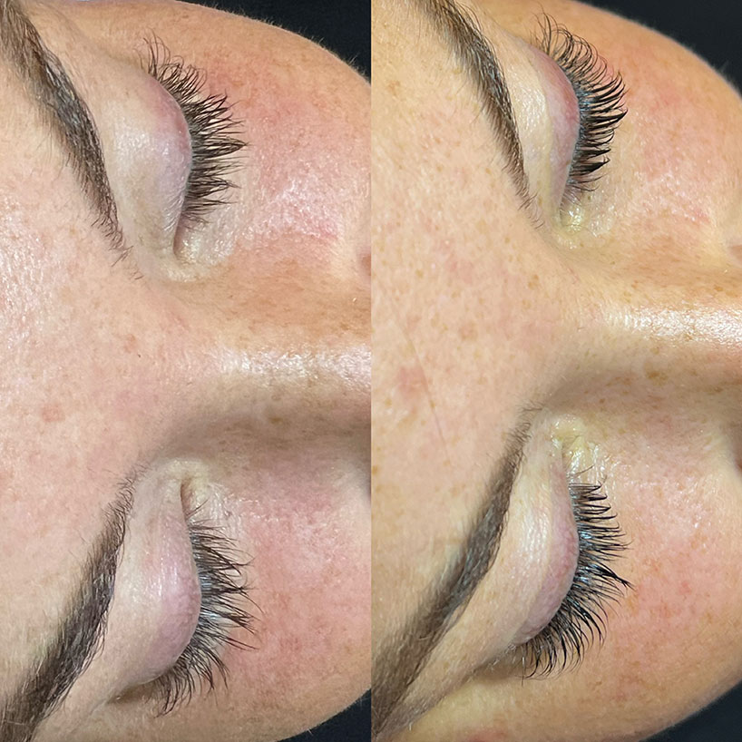 lash-lift-lash-tint-the-laser-lounge-spa-estero-2-before-and-after