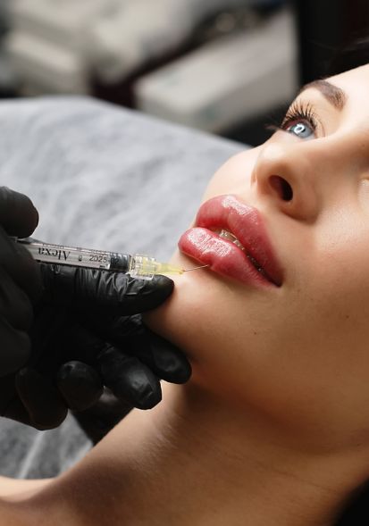 Plump it up with soft, natural-looking volume that enhances your smile—not overpowers it. ​